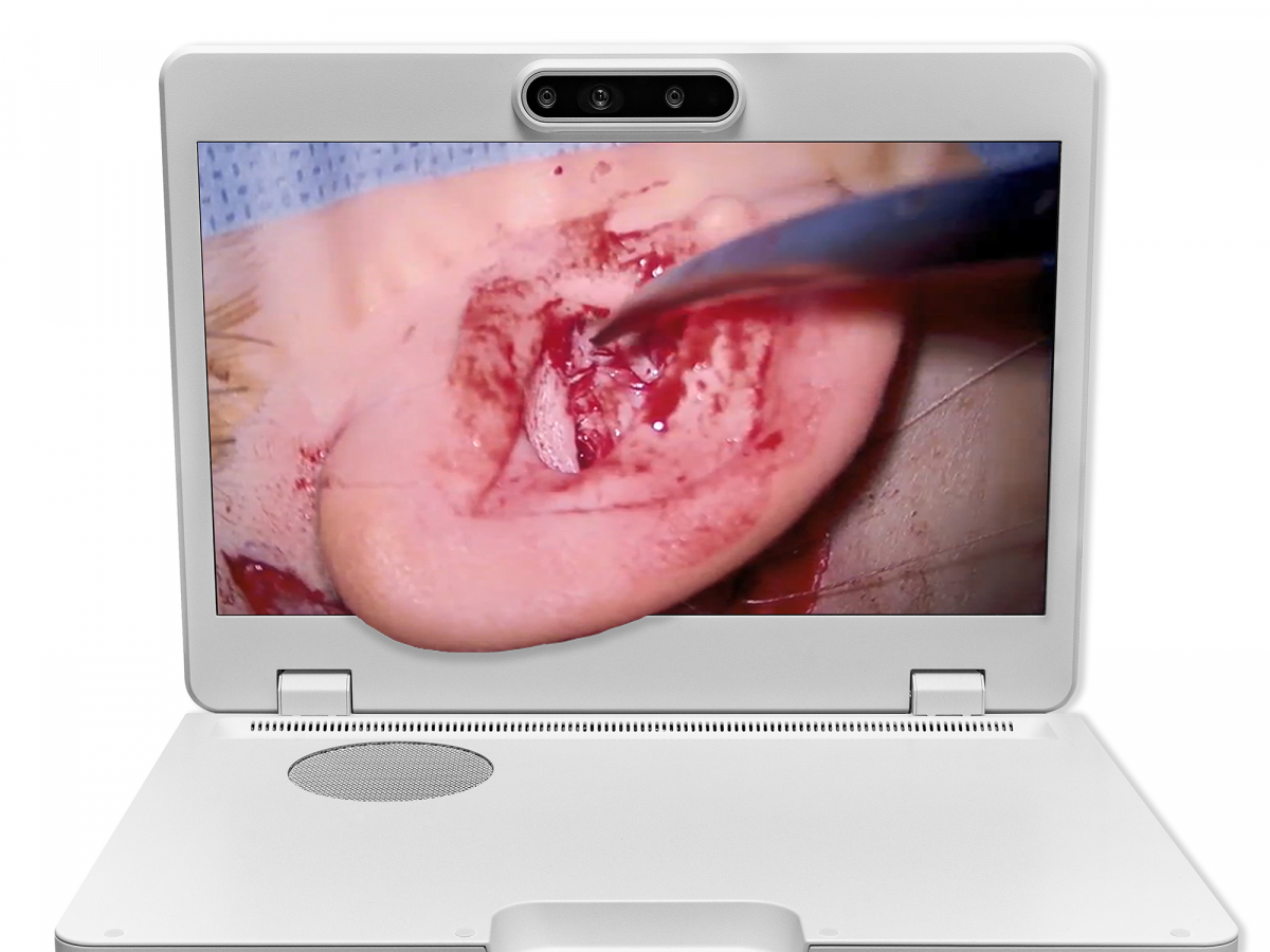 达擎之＂Heads-up 3D显微手术显示系统＂，整合4K裸眼3D显示及眼球追踪系统，具备快速追踪人眼移动位置功能，减轻医师长时间维持固定姿势的负担，让医师能有更宽广清晰的3D立体视野及更舒适的姿势来执行手术。